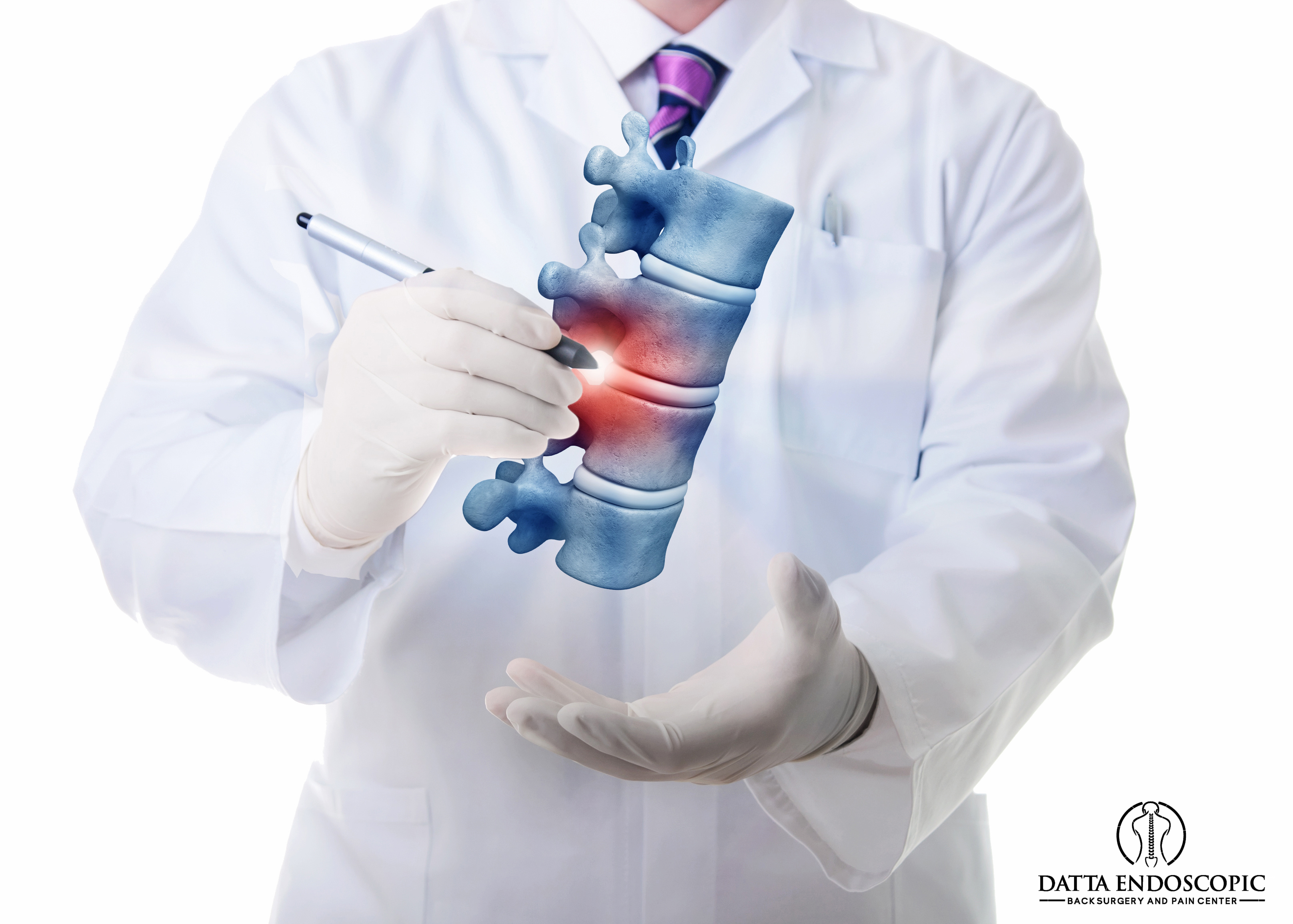 With eDiscSculpt Technique® the Laser Is the Scalpel Dr Sukdeb Datta